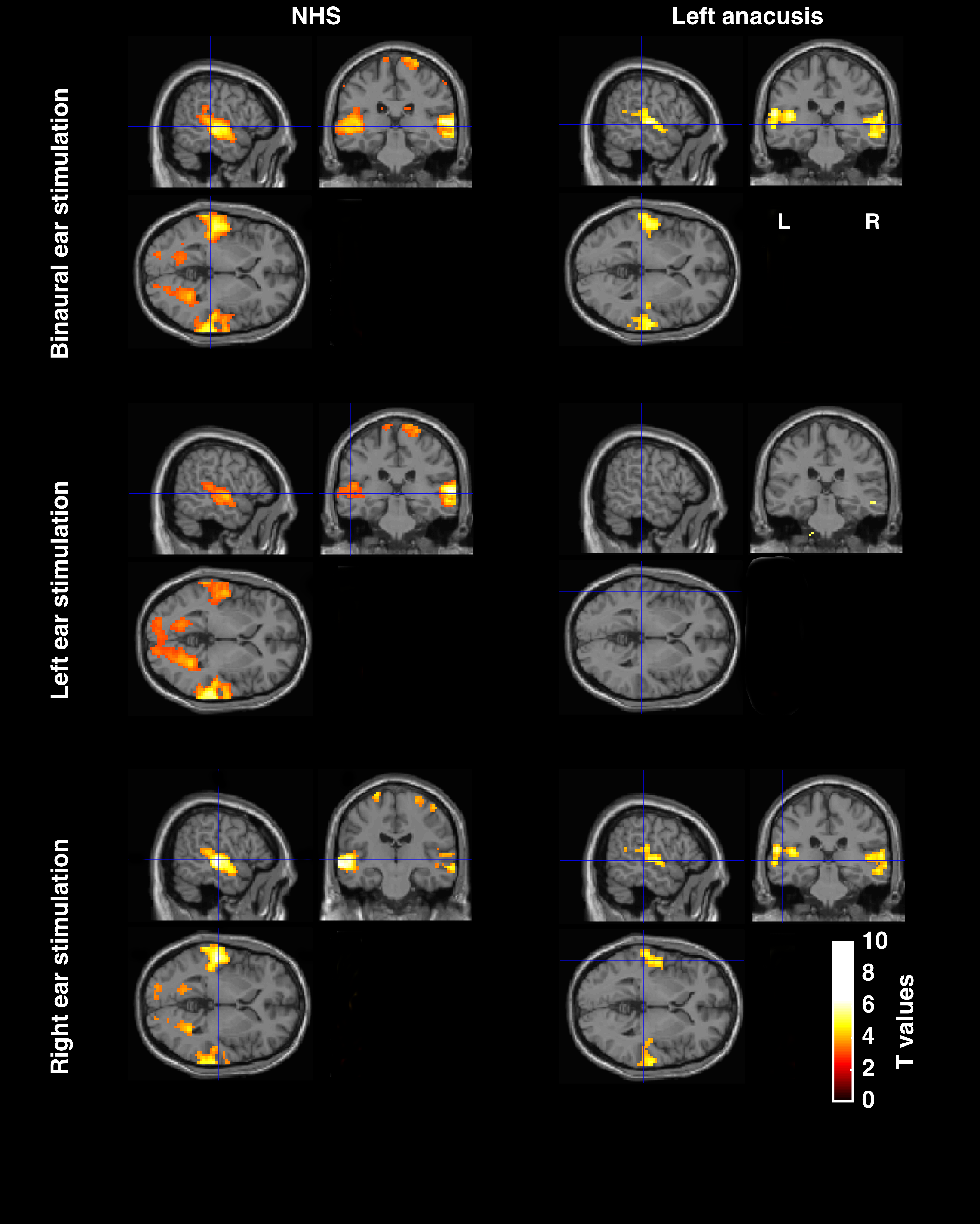 fMRI